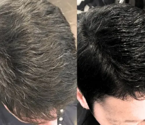 Risultati immediati con NovaHair